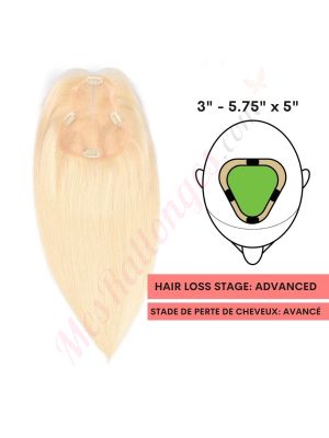 Blond Platine #613   Volumateur (Topper) Perte De Cheveux Sur La Séparation De Cheveux Large Couverture (Dimensions: 3 pouces - 5.75 pouces x 5 pouces) Cheveux Remy Hair