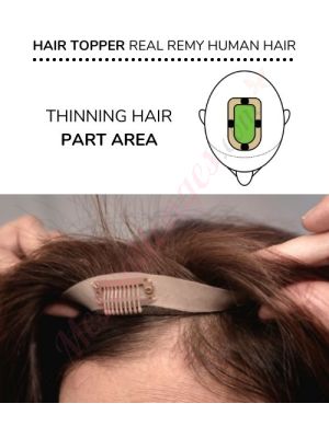 Volumateur Perte De Cheveux Sur La Séparation De Cheveux (Dimensions: 2.75